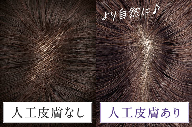 人工皮膚あり/なし
